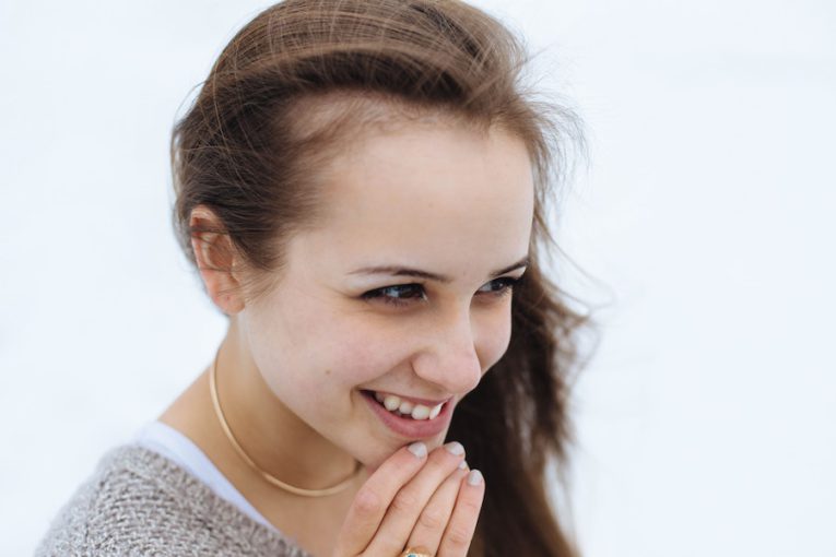 what-you-can-do-about-the-dark-hairs-on-your-chin-myhirsutism