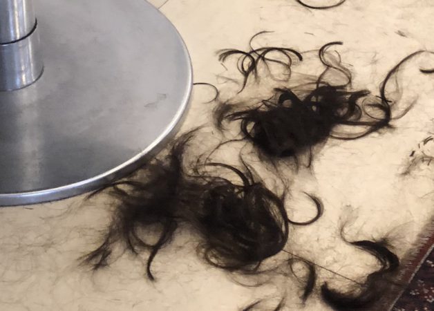 Can Hair Loss From PCOS Be Reversed?