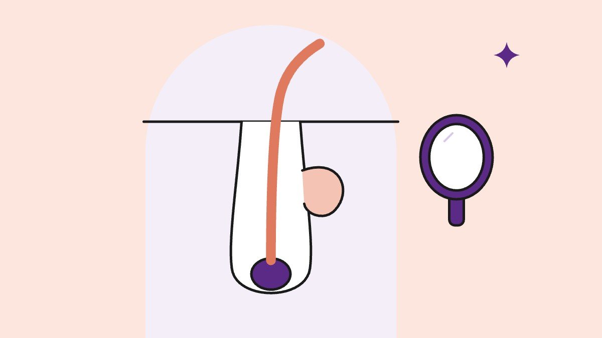 Illustration for: Hirsutism and Acne