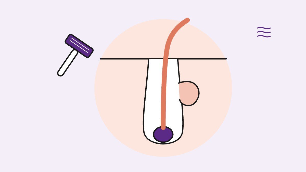 Illustration for: What You Can Do About Enlarged Hair Follicles on Your Breasts
