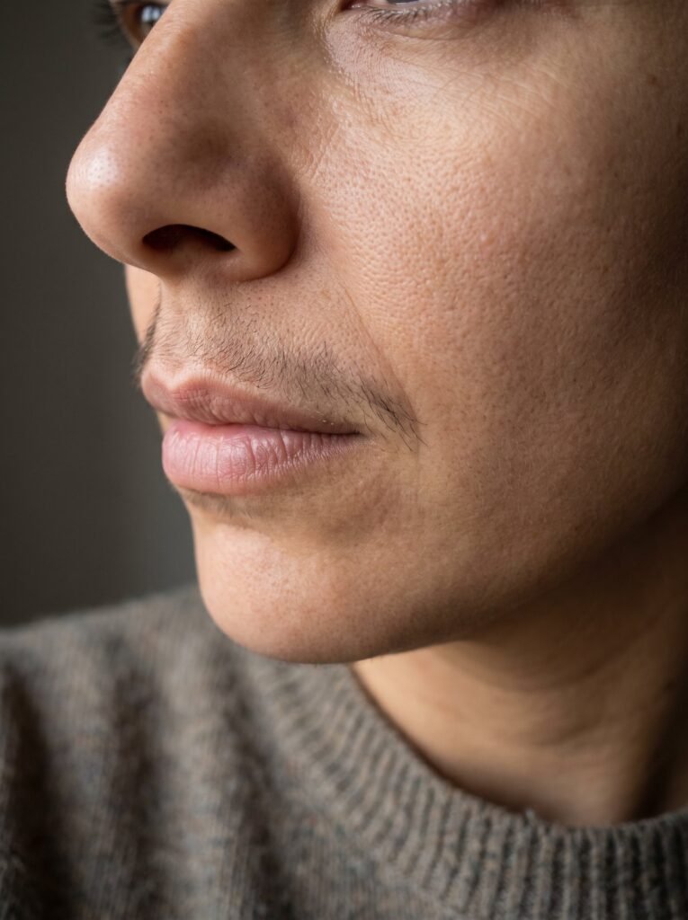 Dark upper lip hair on a woman