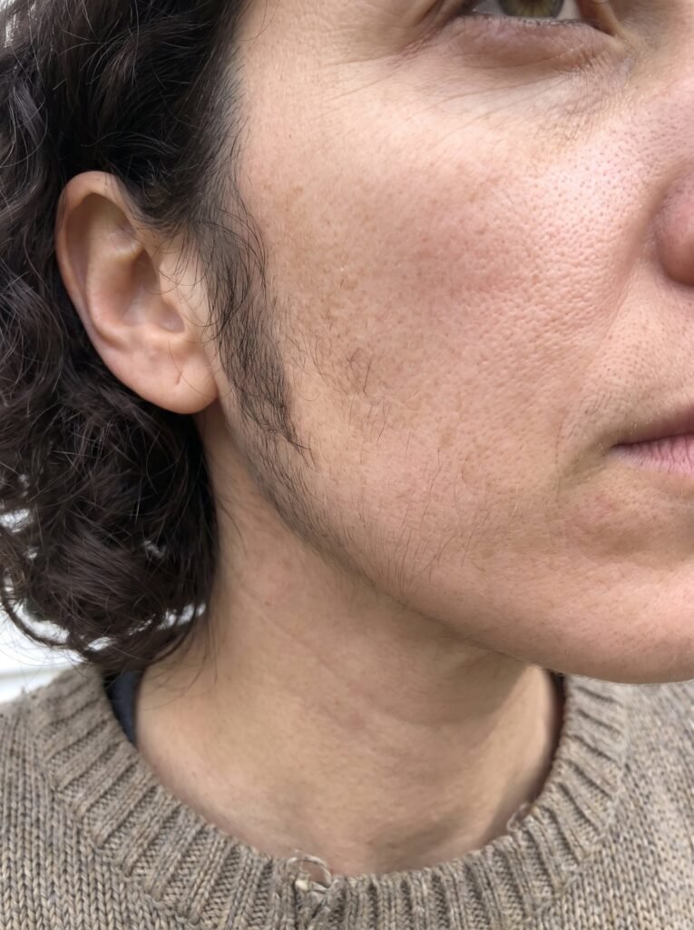 Dark sideburn hair in front of a woman’s ear