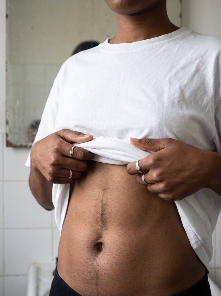 Woman lifting her t-shirt to show hair on her stomach
