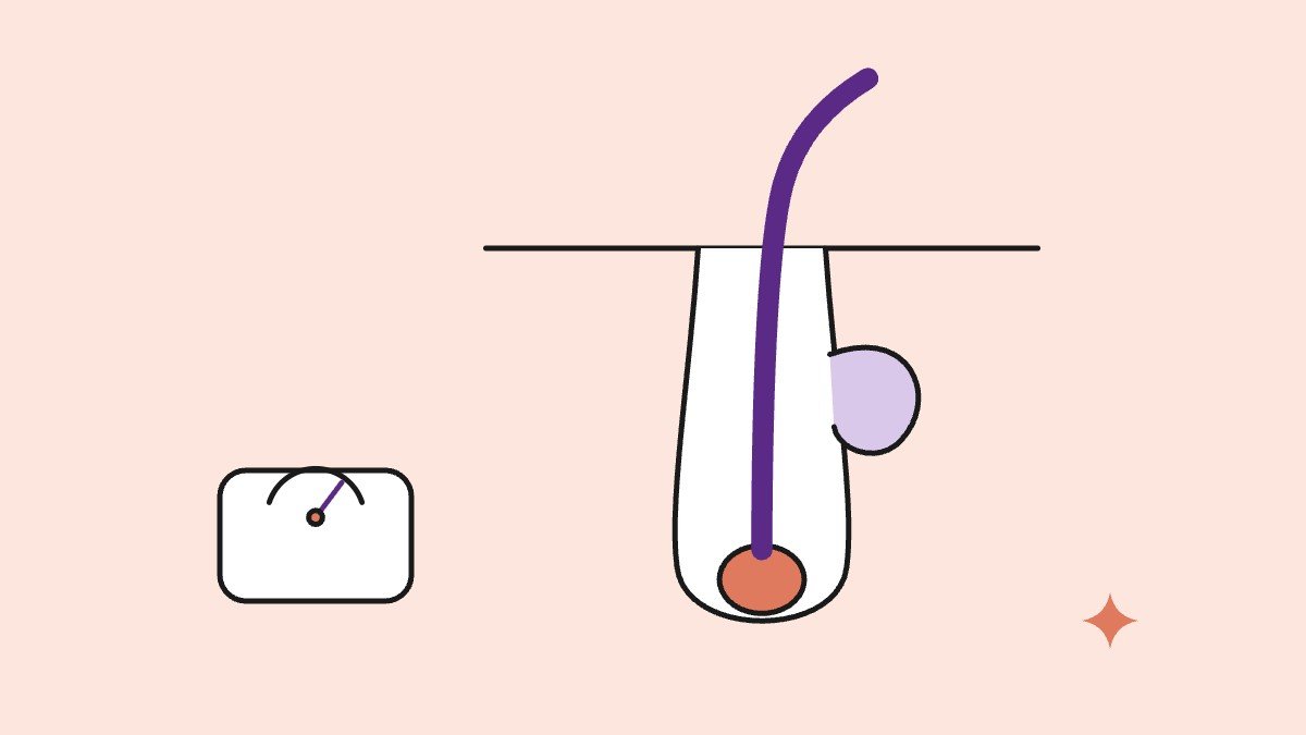 Illustration for: Hirsutism and Trichotillomania