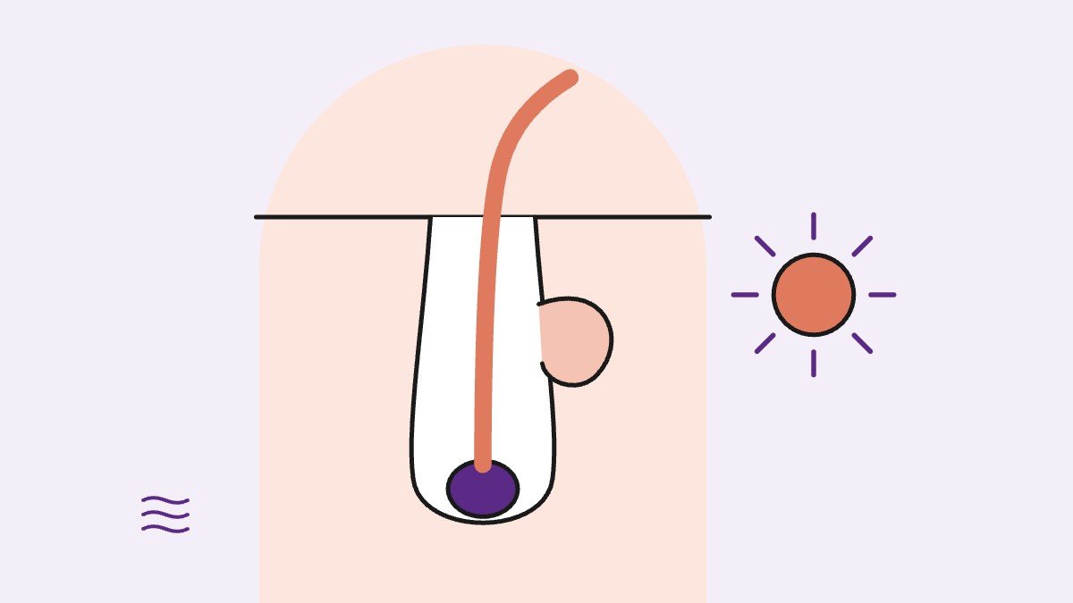 Illustration for: What Is Hirsutism?